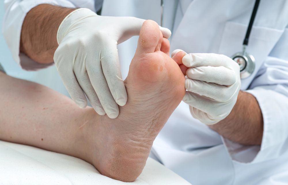 What Are the Best Anti-Fungal Treatments for Athlete's Foot