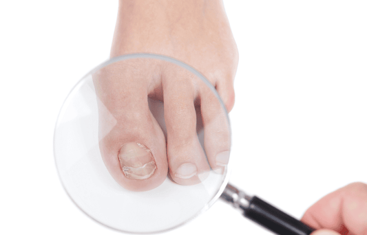 Nail Fungus vs. Nail Trauma: What’s Causing the Thickening and Yellowing?