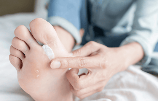 Cream or Spray? How to Treat Fungal Infections Based on Where They Appear
