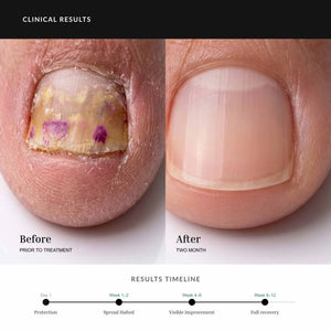 HAND FOOT SPRAY third image
