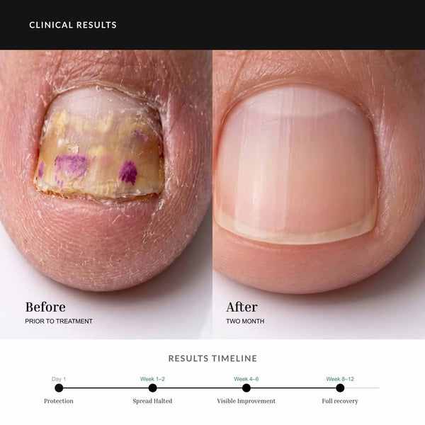 HAND FOOT SPRAY third image