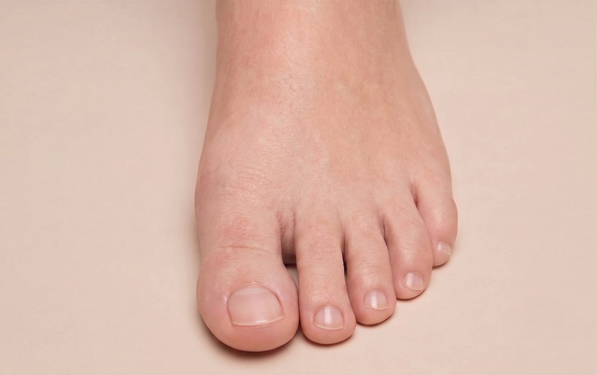 Antifungus after feet example