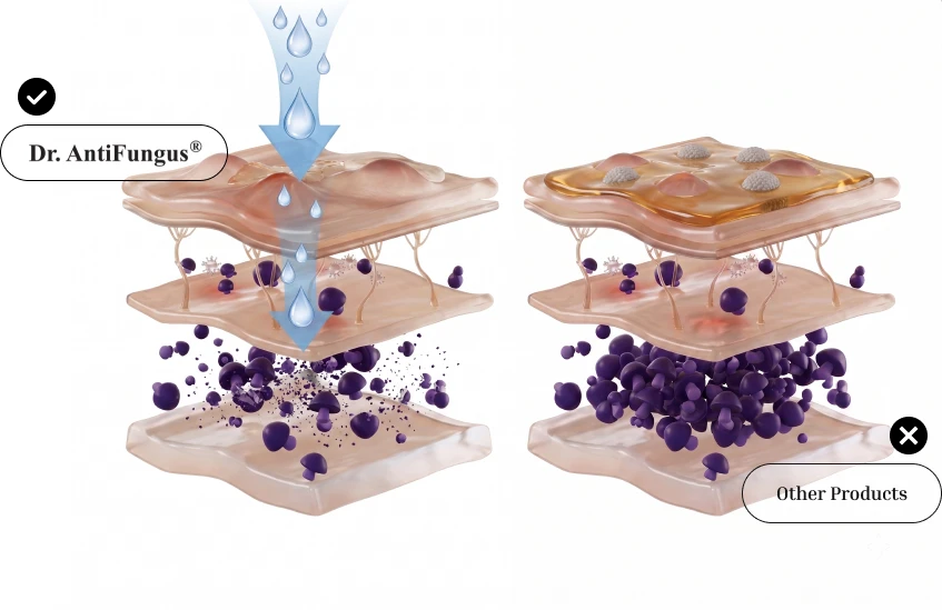 Dr antifungus vs competition