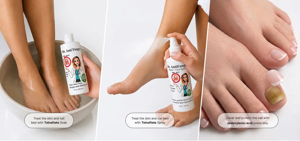Three-panel collage showing a person's feet and toes while using Dr. Anti Fungi treatment.